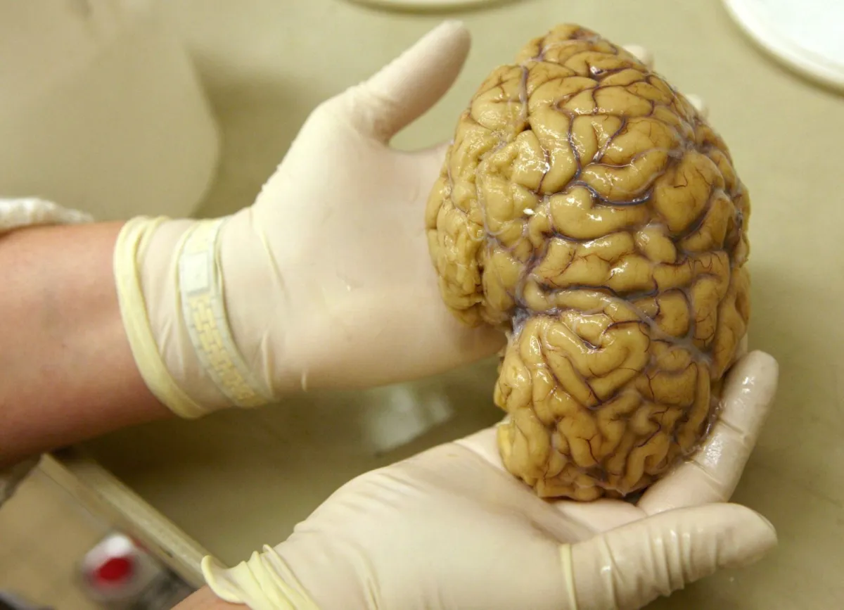Cientistas mapeiam atividade gênica cerebral em busca de respostas para Alzheimer e Parkinson